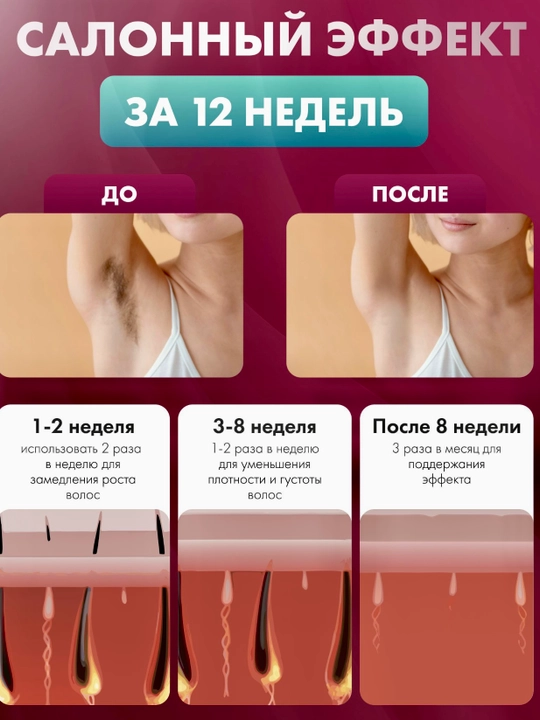 Lazer Depilyator Pro IPL – Oqartiruvchi va Silliq Teri uchun