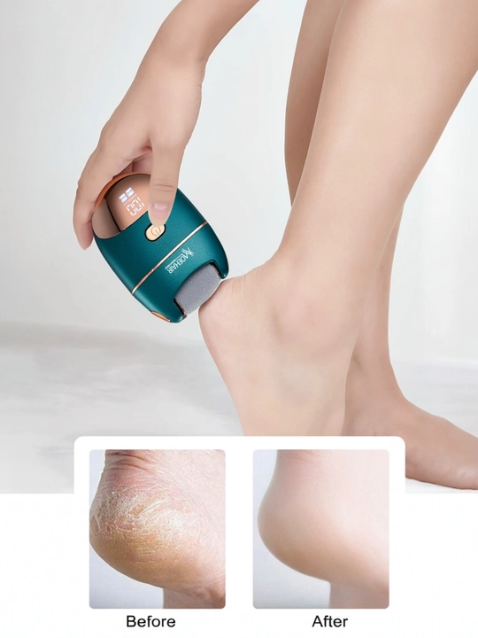Mazollarni ketqazish uchun, Elektric callus remover, MO-9088, MOEHAIR