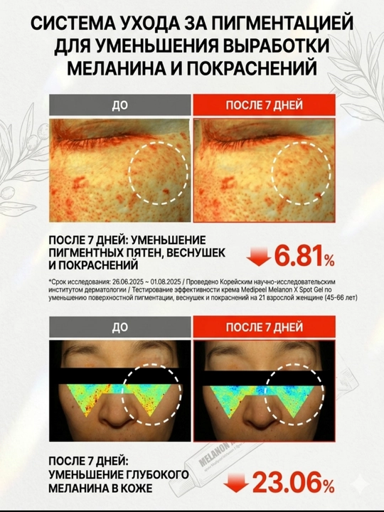 MEDIPEEL Melanon X Spot Gel с ниацинамидом и ретиналем против пигментации и морщин, 15 мл