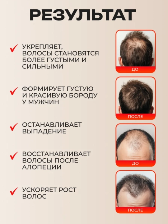 Сыворотка для роста волос и бороды Capixyl 15% AYA, от выпадения и облысения, 30 мл