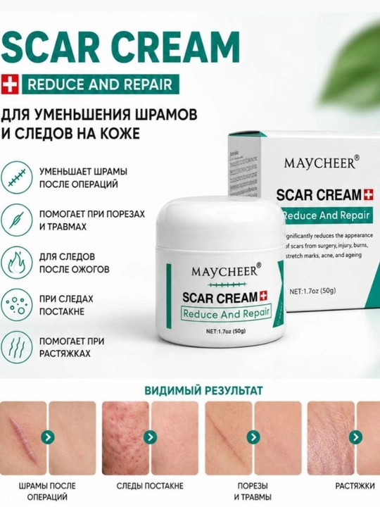 Maycheer крем от рубцов , шрамов , растяжек , пятен после угрей, акне - 