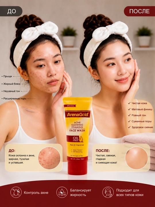 Гель для умывания против акне, для жирной кожи Arena Gold Acne Glopwing Foaming Face Wash