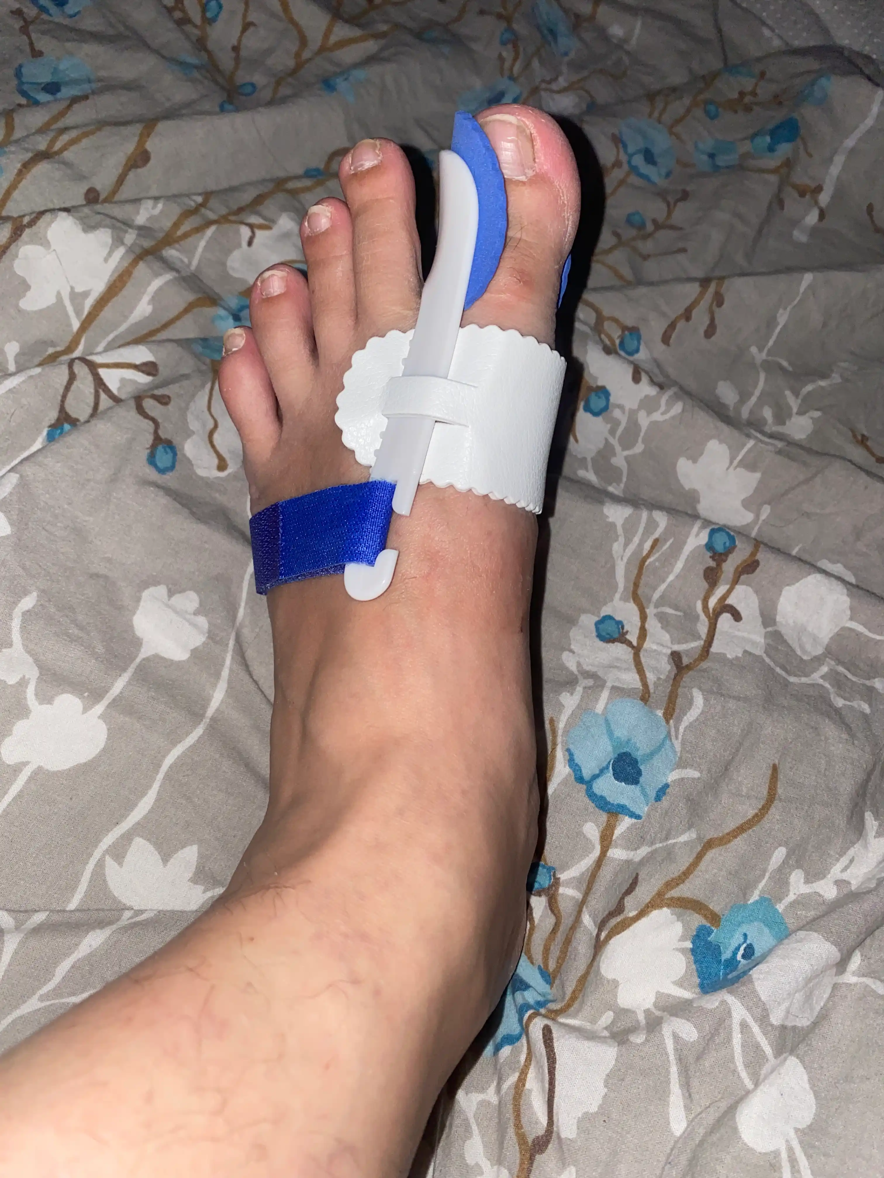 Ортопедический корректор для большого пальца стопы (Hallux Valgus)