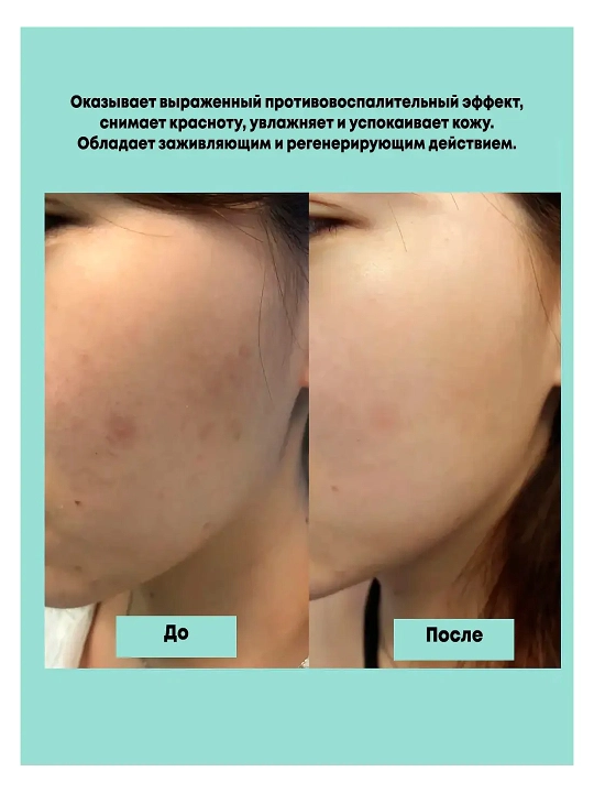 Oqartiruvchi qora tochkalarga qarshi zardob Dark Spot Correcting Glow Serum, Axis-Y, 50 ml