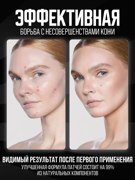 Патчи гидроколлоидные от прыщей акне - точечные звезды и сердца 36,48,280 шт