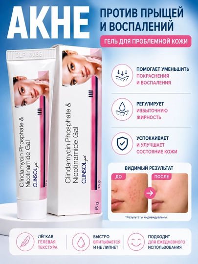 Гель от прыщей и акне и угревой сыпи Clinsol gel, алоэ вера, крем для проблемной кожи лица - 