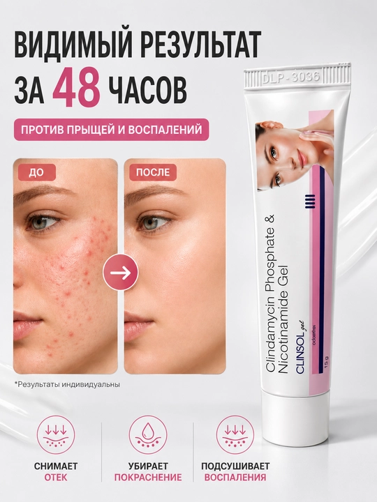 Гель от прыщей и акне и угревой сыпи Clinsol gel, алоэ вера, крем для проблемной кожи лица