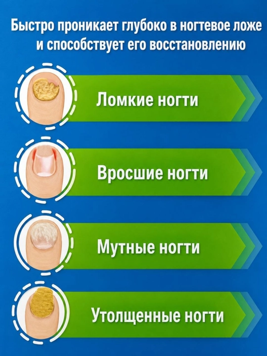 Мазь для ногтей против грибка, уход и восстановление ногтевой пластины, 20 г