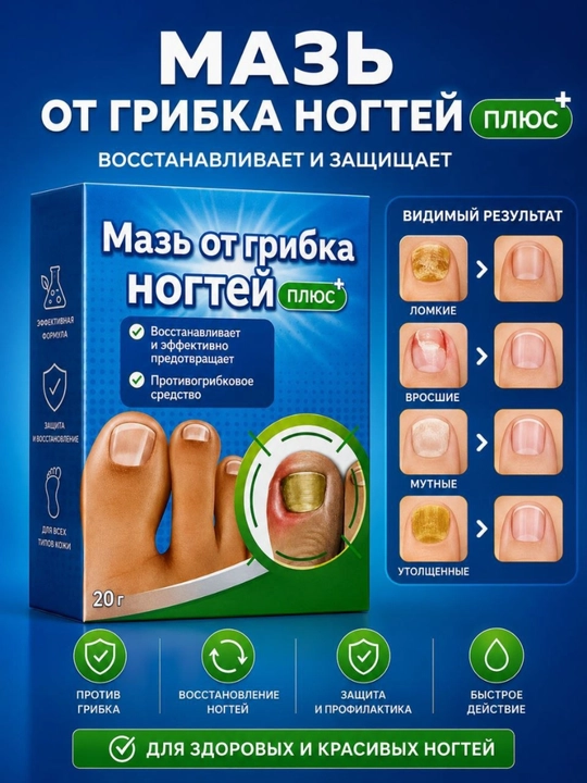 Мазь для ногтей против грибка, уход и восстановление ногтевой пластины, 20 г