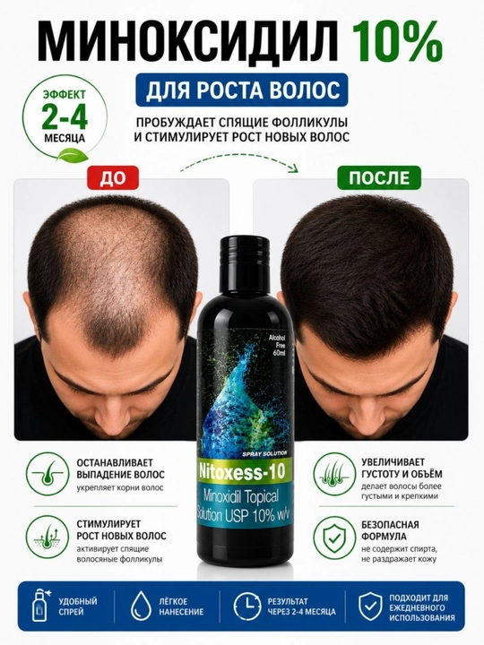 Миноксидил 10% средство от облысения активация роста волос бороды усов, 60 мл