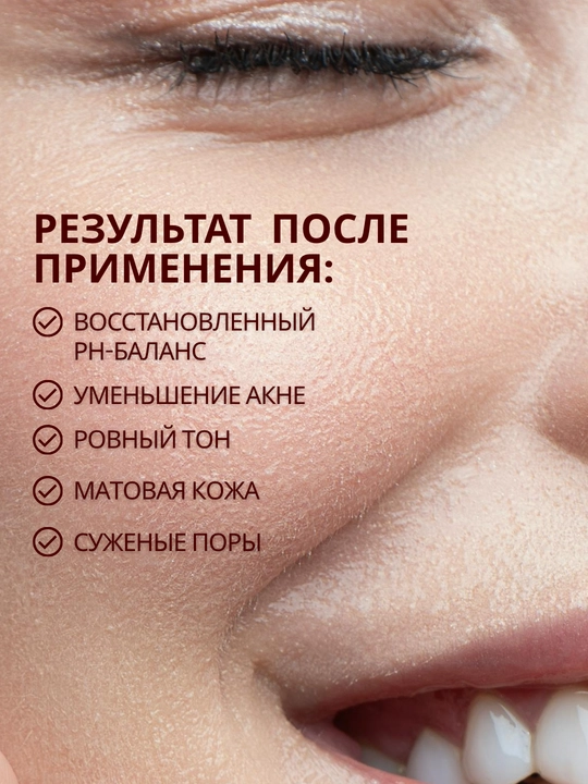 MI&KO Тоник осветляющий, отбеливающий, матирующий, от акне, 110 мл MIKO