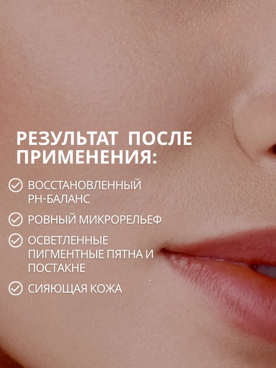 MI&KO Тоник осветляющий, отбеливающий, матирующий, от акне, 110 мл MIKO