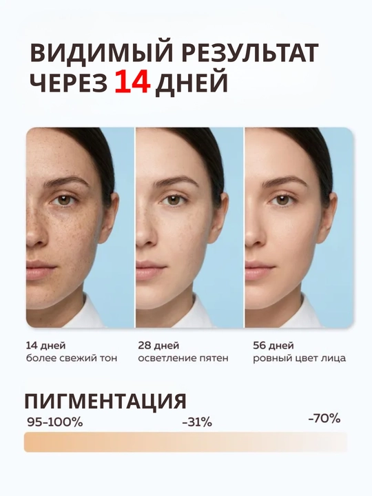 MI&KO крем ночной, дневной от пигментации, осветляющий, от акне и прыщей 30 мл