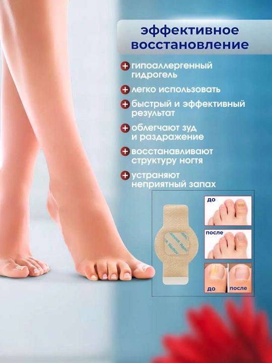 Пластырь от грибка ногтей лечебный киноки лейкопластырь от вросших ногтей для ног