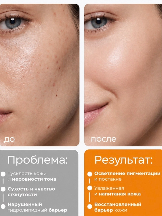 DR. Althea Melaclear Cream — Осветляющий крем для лица, против пигментации и постакне