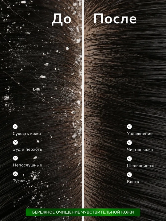 Kerasys Scalp Deep Cleansing shampuni, qazg‘oqqa qarshi, normal va quruq bosh terisi uchun