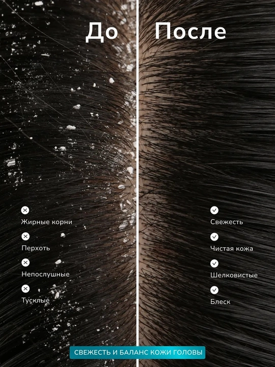 Kerasys Scalp Balancing shampuni, qazg‘oqqa qarshi, yog‘li bosh terisi uchun