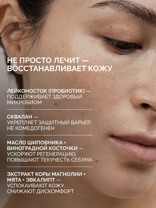 MI&KO Крем против акне для лица ACNE.NET, 30 мл MIKO