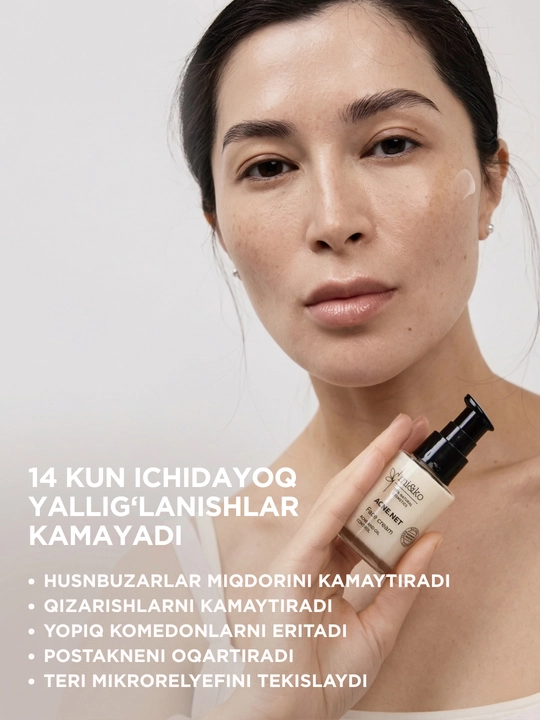 MI&KO Крем против акне для лица ACNE.NET, 30 мл MIKO