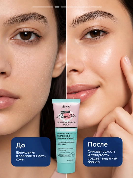 Увлажняющий и матирующий крем для лица CLEAN SKIN,против прыщей, 40 мл, Витэкс