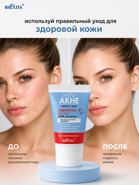 Yuz uchun zardob Aknega qarshi, azelain + rux, akne nazorati, 30 ml, BiElita