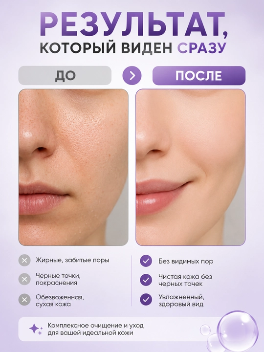 Celimax Derma Nature Fresh Blackhead Jojoba Cleansing Oil — гидрофильное масло