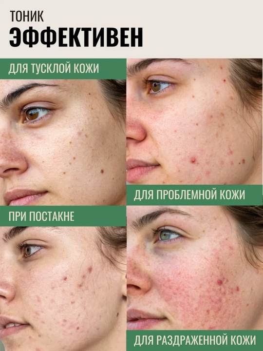 Тонер для лица Axis-Y: Triple PDRN toner, Dark Spot мист - тонер, Daily Purifying Treatment