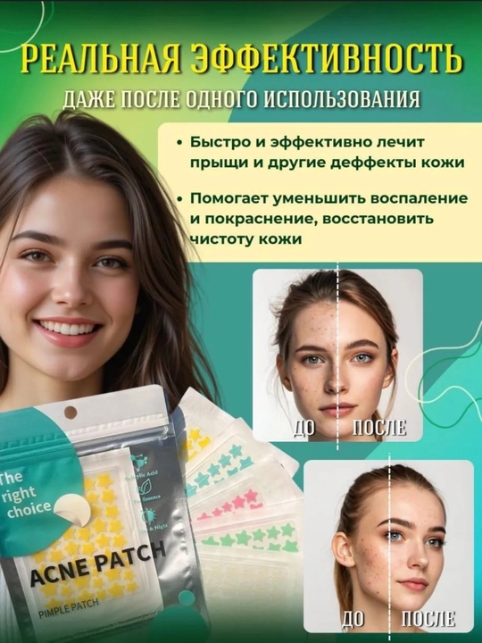Патчи от прыщей и акне, патчи-пластыри, гидроколлоидные, различных размеров