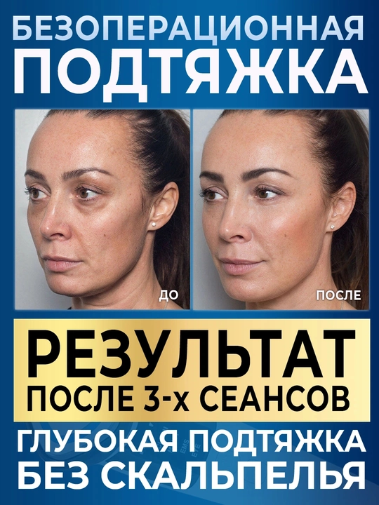 Массажер для лица ультразвуковой EMS RF лифтинг 7 в 1