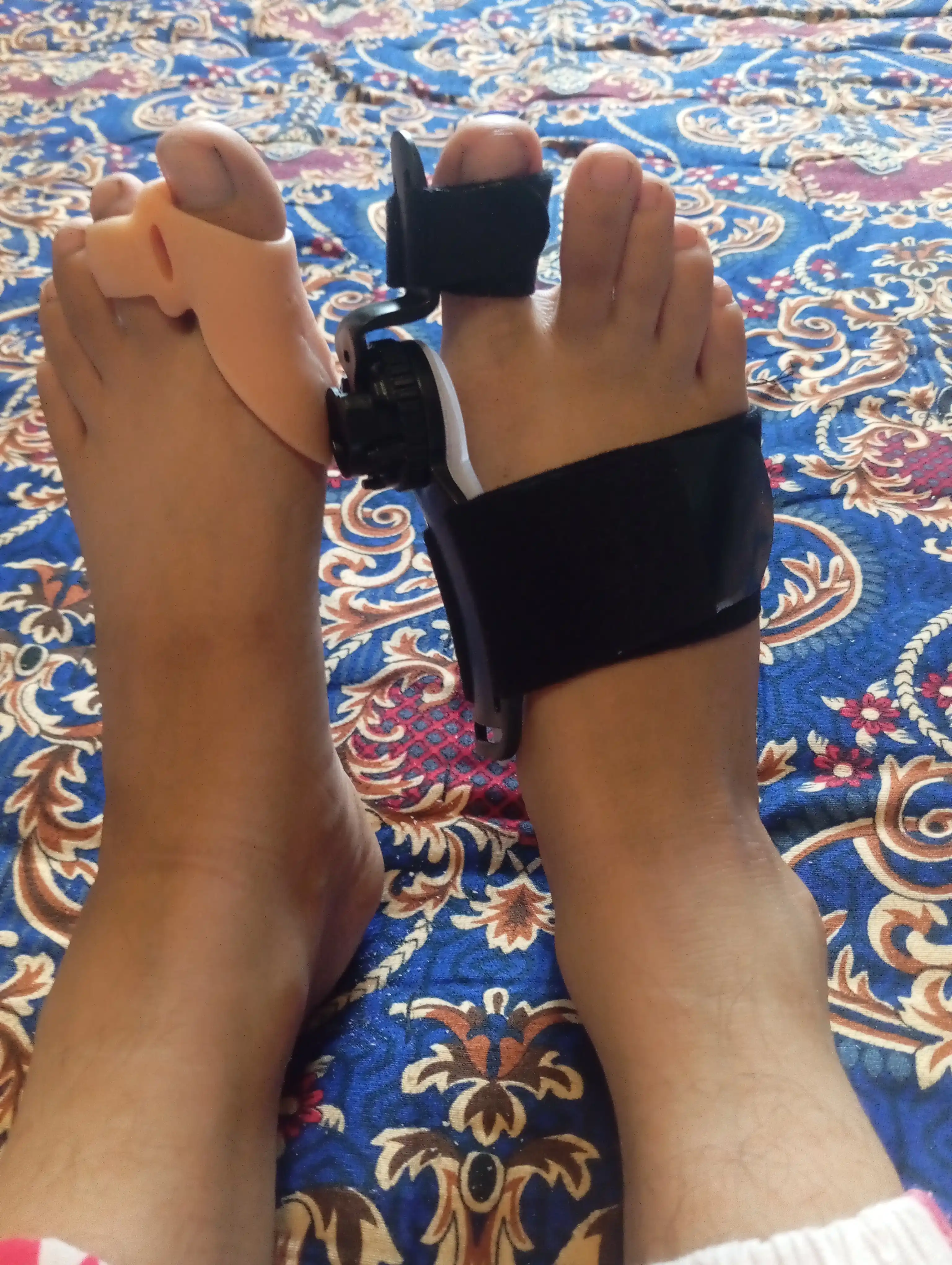 Разделитель пальцев ног, корректор hallux valgus большого пальца стопы, бандаж для ног
