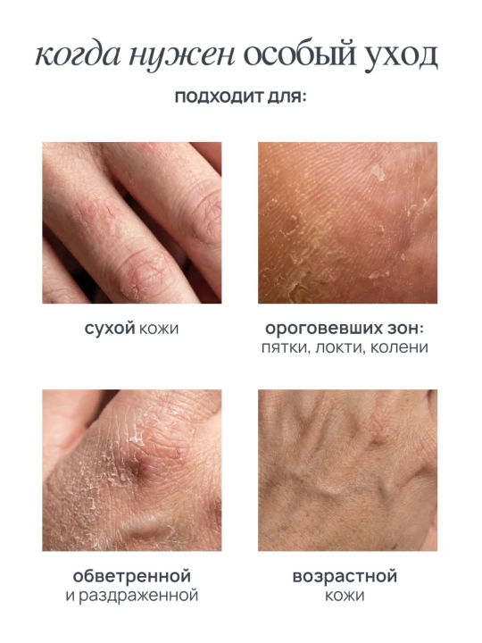 Крем для тела увлажняющий с мочевиной MIXIT LAB для сухой кожи, 460 мл