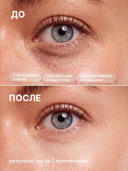 Корейские патчи для глаз Medicube PDRN Pink Caffeine Collagen Patch от синяков и отеков