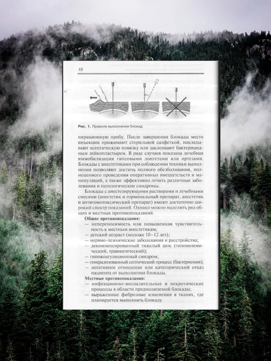 Блокады в травматологии и ортопедии – Практическое руководство (без CD)