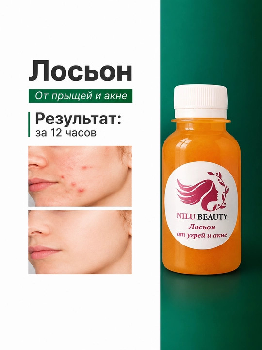 Лосьон против угрей, удаление акне для всех типов кожи лица