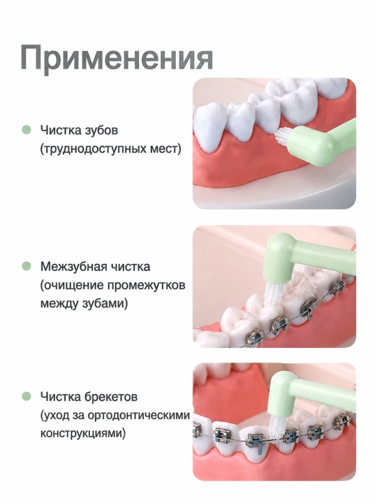 Breket, implant, elayner uchun bir tutamli tish cho‘tkasi, ortodontik cho‘tka, 2 dona