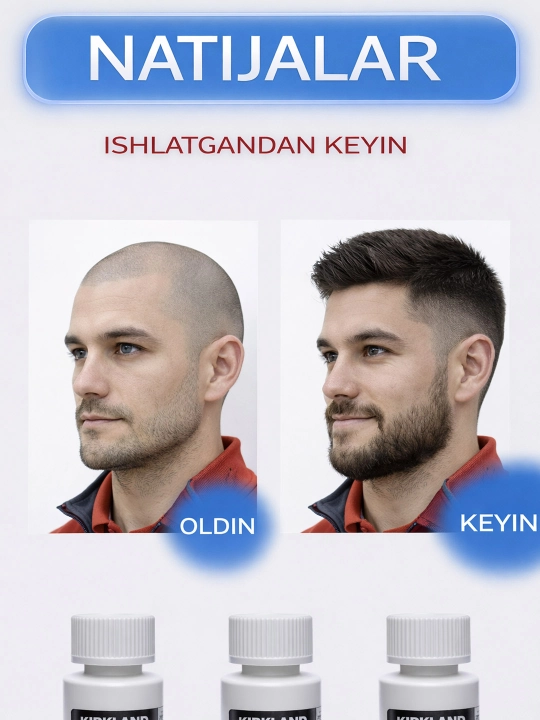 Soch va soqol o'stirish uchun minoksidil Kirkland Minoxidil 5%, 60 ml