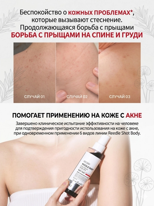 Спрей от прыщей и акне на спине и груди VT Reedle Shot B-Clear AC, 150 мл