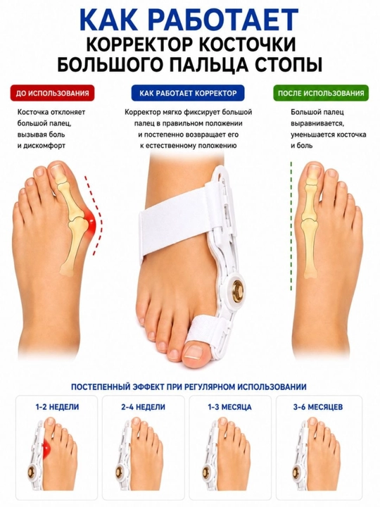 Bosh barmoq uchun sozlanadigan Hallux Valgus fiksatori - 1 dona