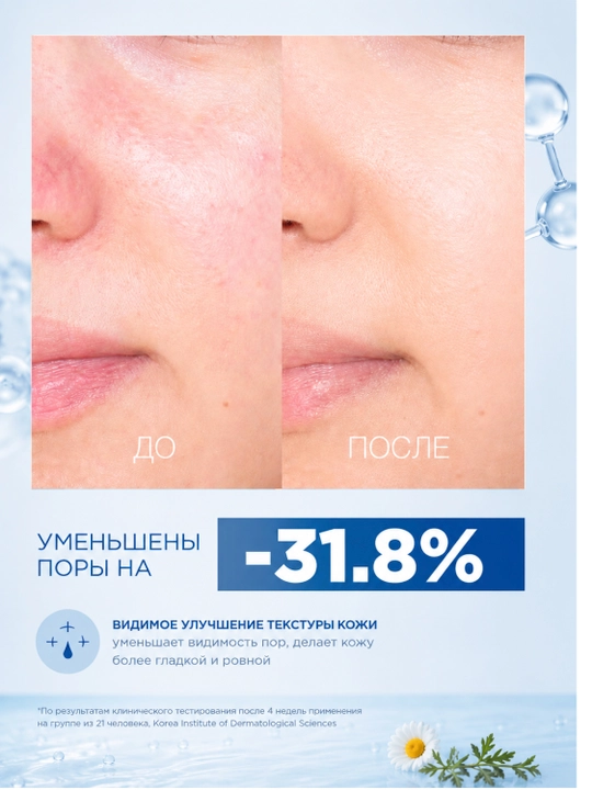Tonik+lotion to‘plami, TONYMOLY Azulene 2×200 ml muammoli teri uchun tinchlantiruvchi