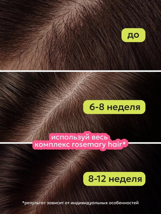 Likato soch o'sishini kuchaytirish uchun bibariya qo'shilgan tonik zardobi, 150 ml