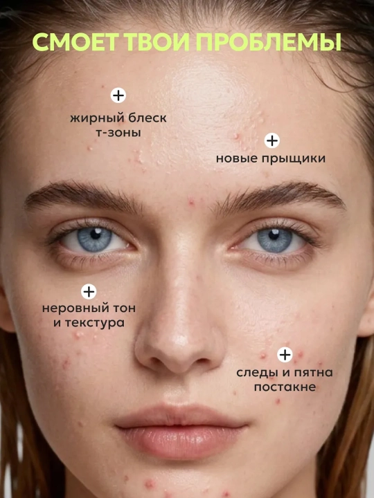 Likato POST ACNE yog'lilik va husnbuzarlarga qarshi tozalovchi yuz ko'pigi, 150 ml