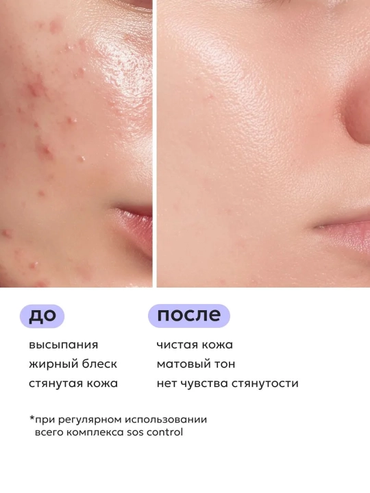 Гель для умывания Likato SOS CONTROL для проблемной кожи лица, очищающий, 250 мл