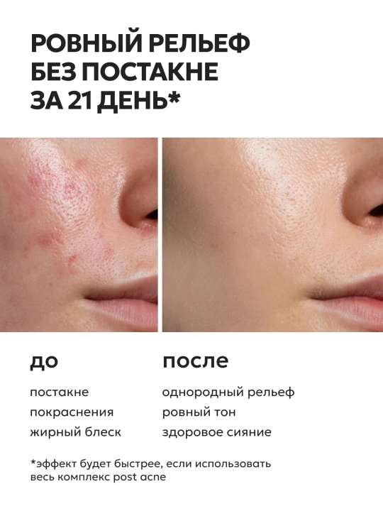 LIKATO POST ACNE yuz yuvish uchun fermentli (enzim) pudra, xusnbuzarga qarshi, 120 g