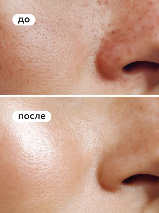 LIKATO POST ACNE yuz yuvish uchun fermentli (enzim) pudra, xusnbuzarga qarshi, 120 g