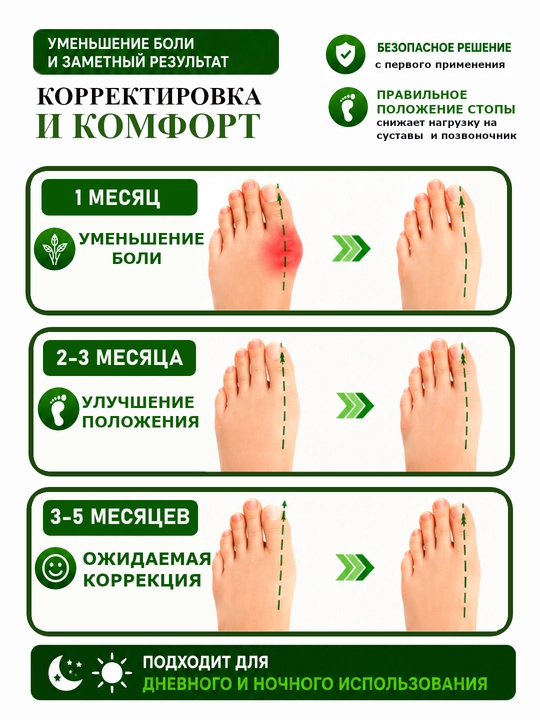 Разделитель пальцев ног, корректор hallux valgus большого пальца стопы, бандаж для ног