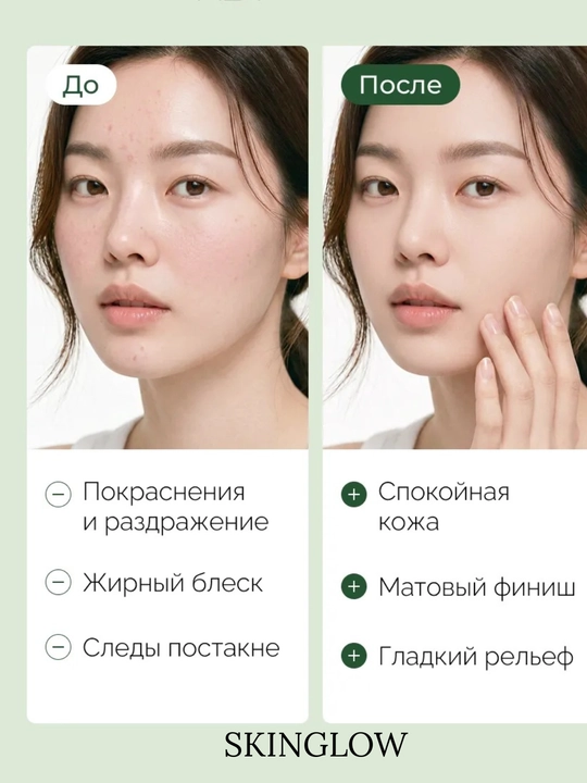 Сыворотки для лица от Anua с PDRN, ниацинамидом, омолаживающая увлажняющая питательная