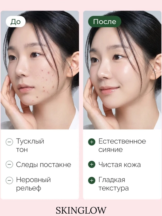 Сыворотки для лица от Anua с PDRN, ниацинамидом, омолаживающая увлажняющая питательная