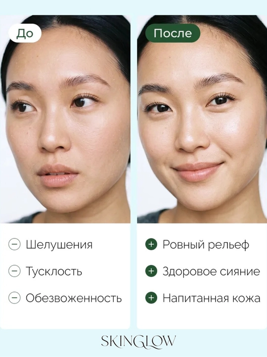 PDRN va gialuron kislotali namlantiruvchi krem Anua PDRN Hyaluronic Acid 100 Cream
