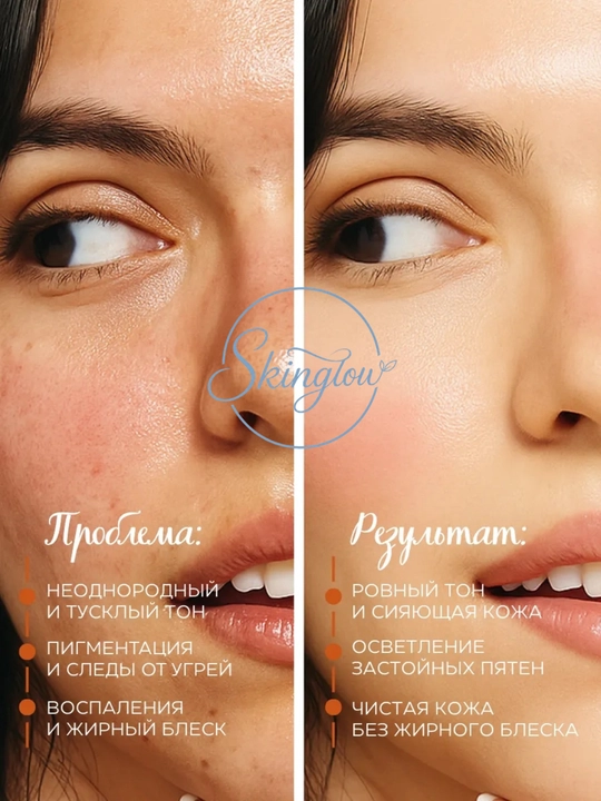 Muammoli teri uchun chakanda antioksidant zardobi Dr. Althea Gentle Vitamin C Serum