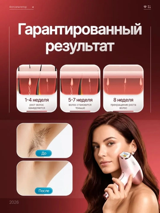 Babyverse Фотоэпилятор профессиональный, для лица и тела, с эффектом охлаждения